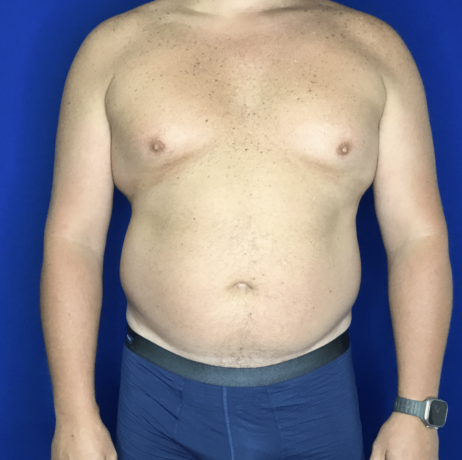 A Man In A Blue Shirt